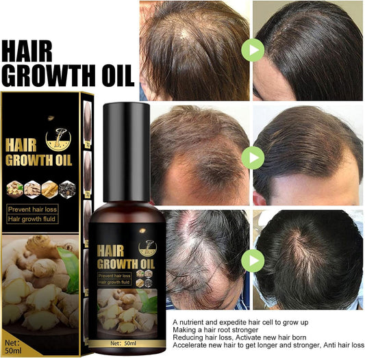 Hair Growth Oil 100ml Each - Pack Of 2